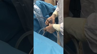 Лазерная вапоризация аденомы предстательной железы